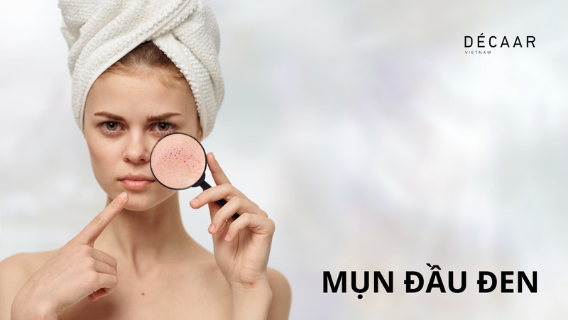 mụn đầu đen là gì